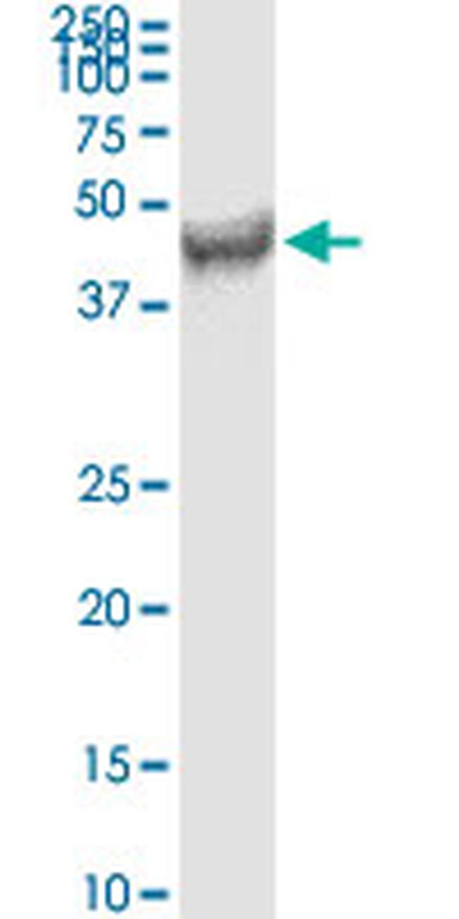 FDFT1 Antibody in Western Blot (WB)