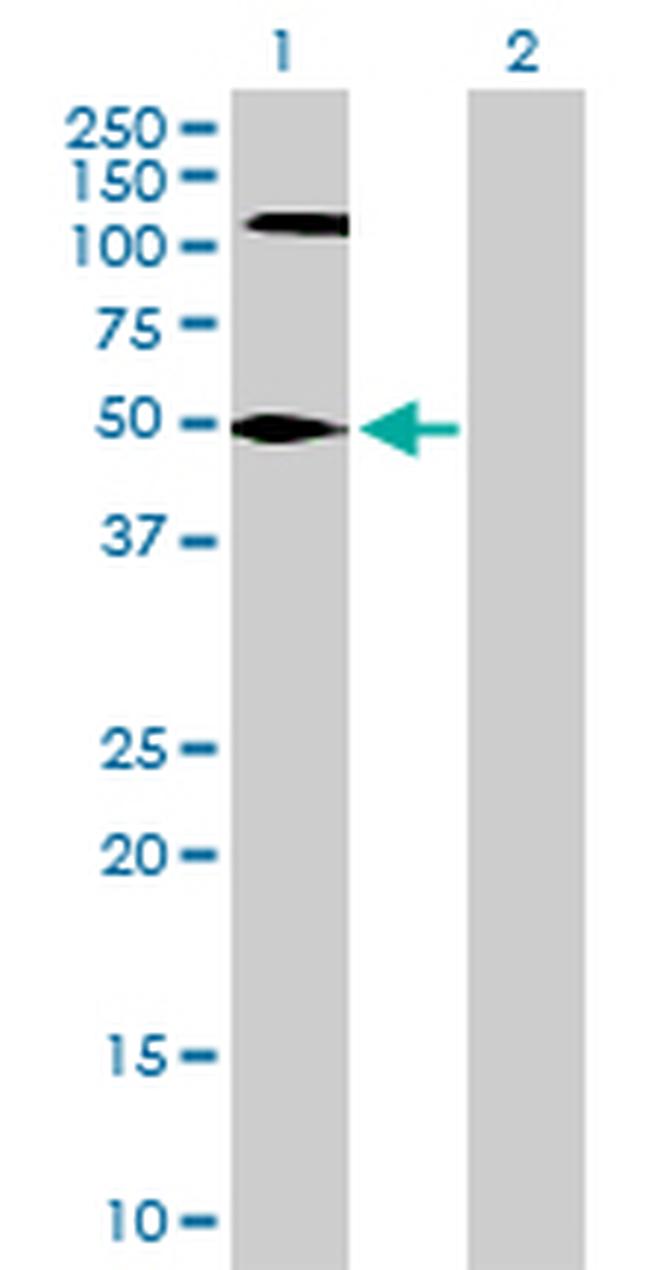 FEN1 Antibody in Western Blot (WB)