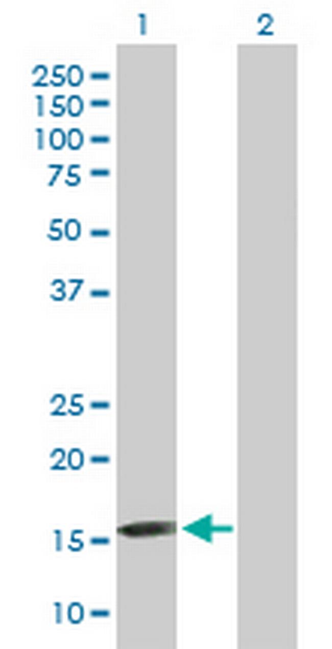 FGF1 Antibody in Western Blot (WB)