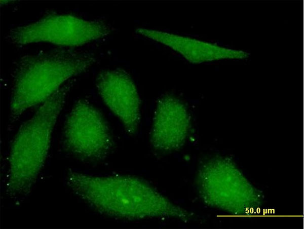 FGF1 Antibody in Immunocytochemistry (ICC/IF)