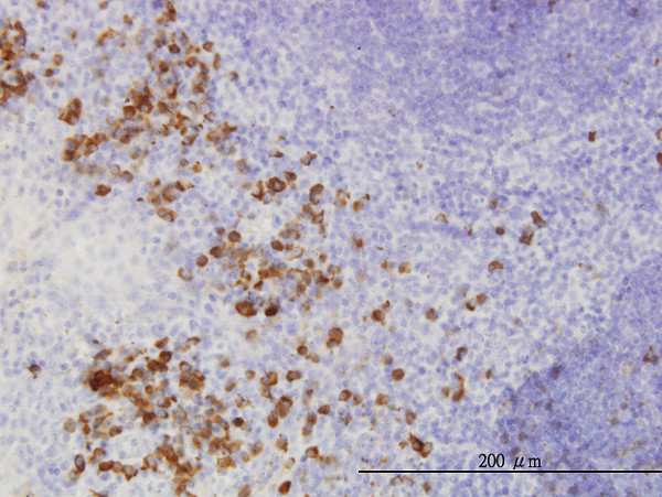 FGF1 Antibody in Immunohistochemistry (Paraffin) (IHC (P))