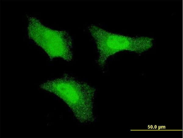 FGF1 Antibody in Immunocytochemistry (ICC/IF)