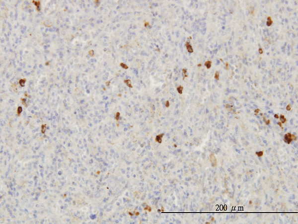 FGF1 Antibody in Immunohistochemistry (Paraffin) (IHC (P))