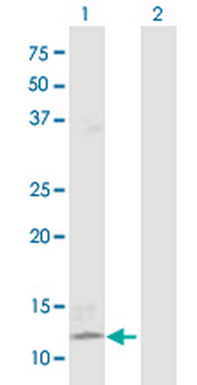 FGF5 Antibody in Western Blot (WB)