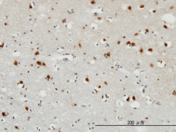 FGF12 Antibody in Immunohistochemistry (Paraffin) (IHC (P))