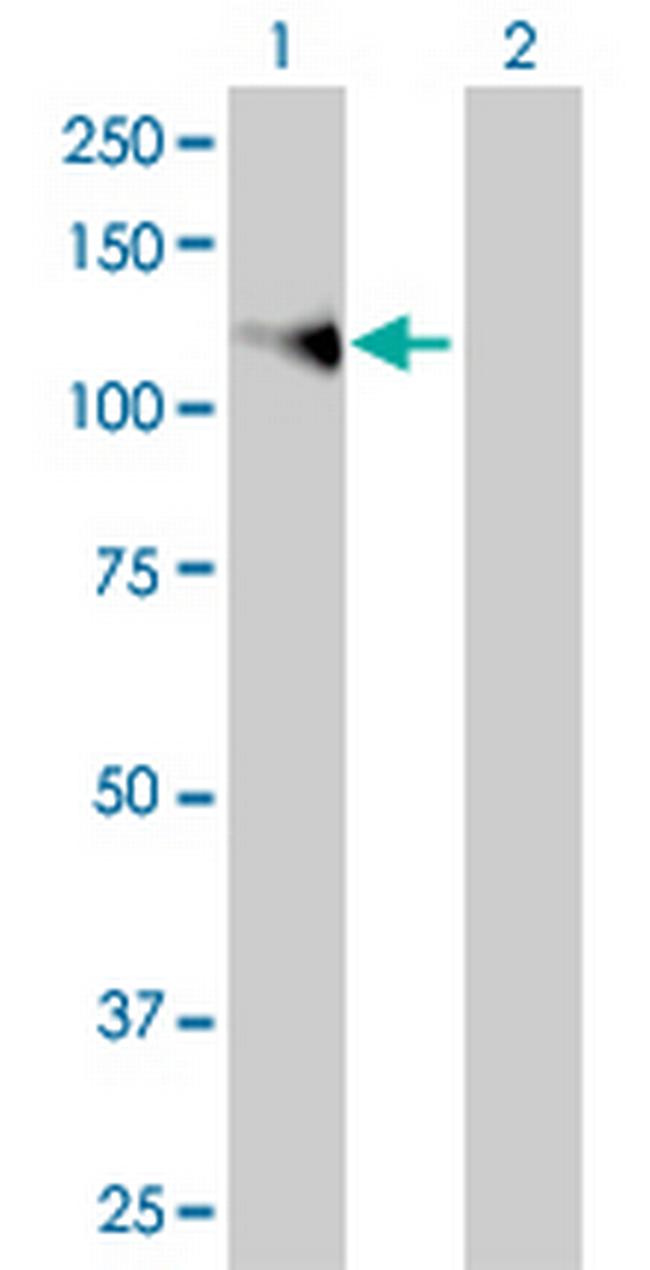 FGFR1 Antibody in Western Blot (WB)