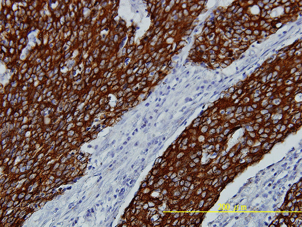 FGFR2 Antibody in Immunohistochemistry (Paraffin) (IHC (P))