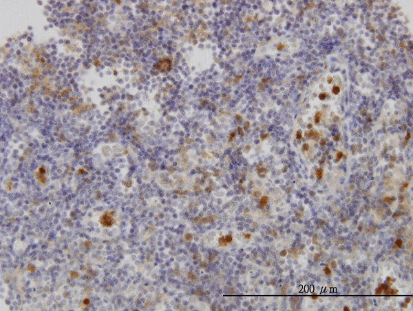 FGR Antibody in Immunohistochemistry (Paraffin) (IHC (P))