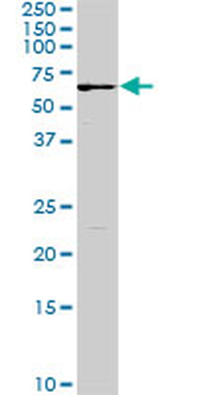 FGR Antibody in Western Blot (WB)