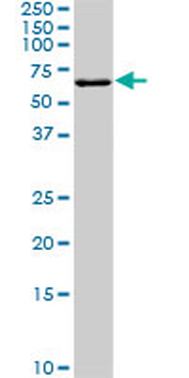 FGR Antibody in Western Blot (WB)