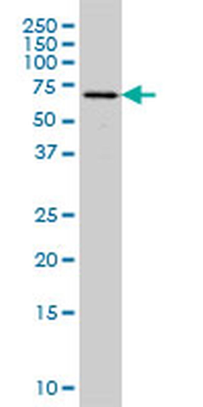 FGR Antibody in Western Blot (WB)