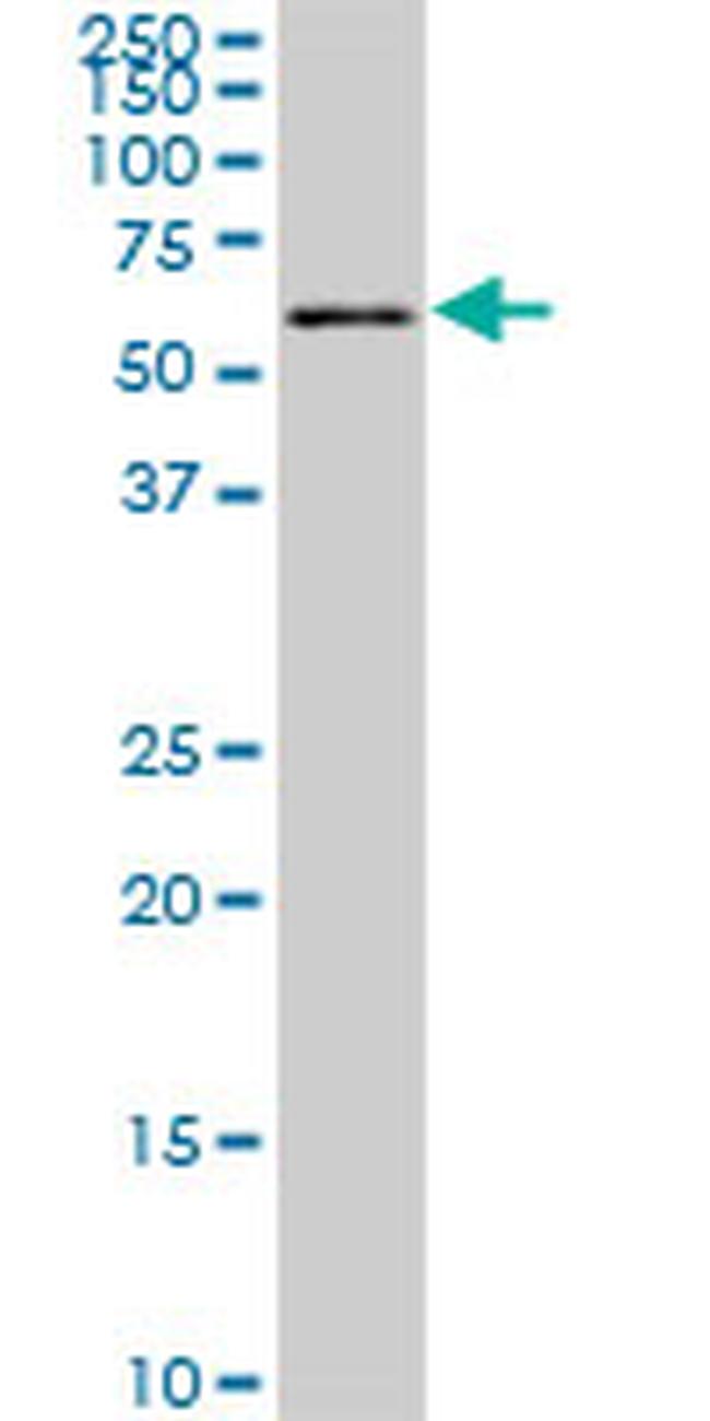 FGR Antibody in Western Blot (WB)