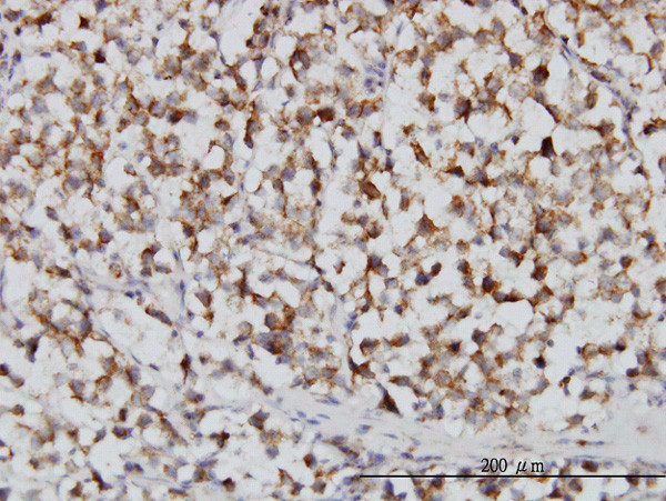 FH Antibody in Immunohistochemistry (Paraffin) (IHC (P))