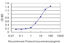 FHL1 Antibody in ELISA (ELISA)