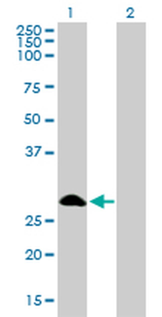 FHL1 Antibody in Western Blot (WB)