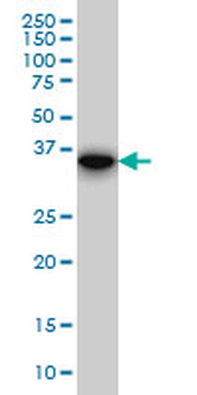 FHL1 Antibody in Western Blot (WB)