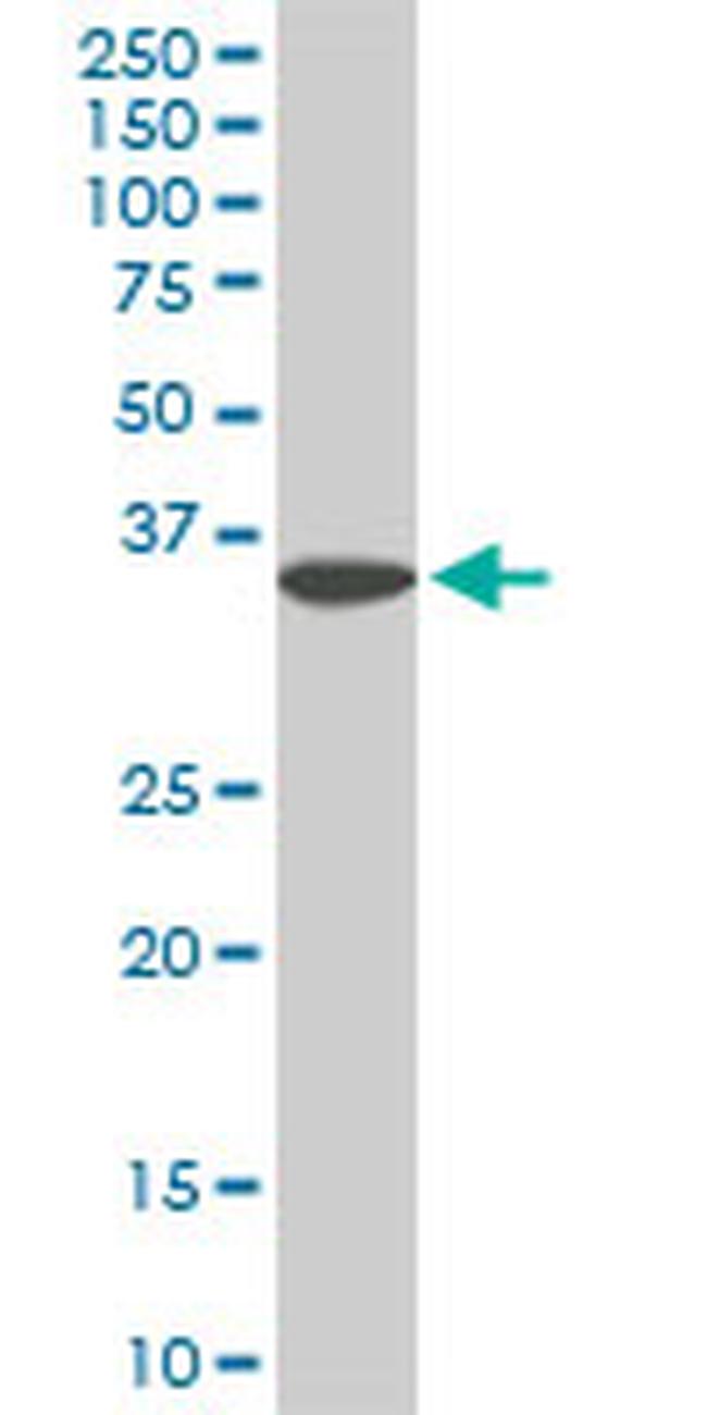 FHL1 Antibody in Western Blot (WB)