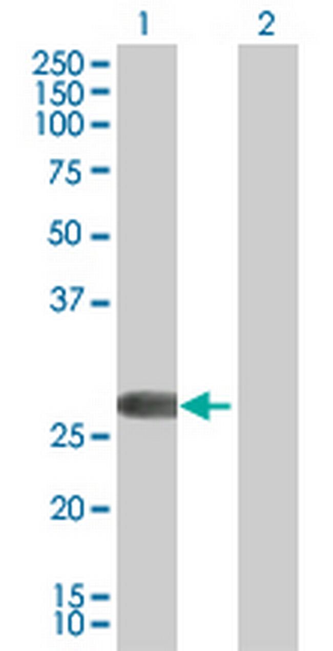 FHL2 Antibody in Western Blot (WB)