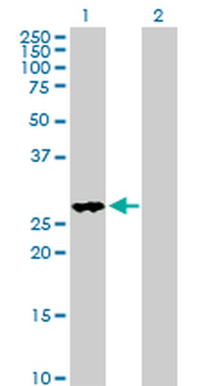 FHL2 Antibody in Western Blot (WB)