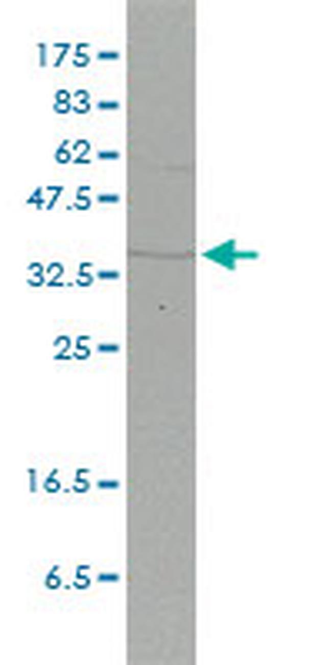 FHL2 Antibody in Western Blot (WB)