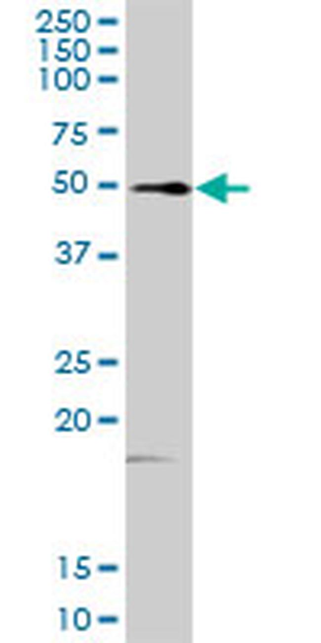 FKBP4 Antibody in Western Blot (WB)