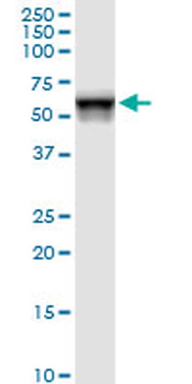 FKBP4 Antibody in Western Blot (WB)