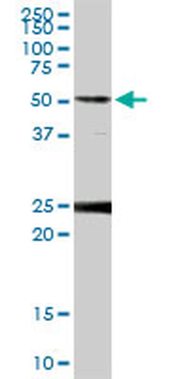 FKBP4 Antibody in Western Blot (WB)