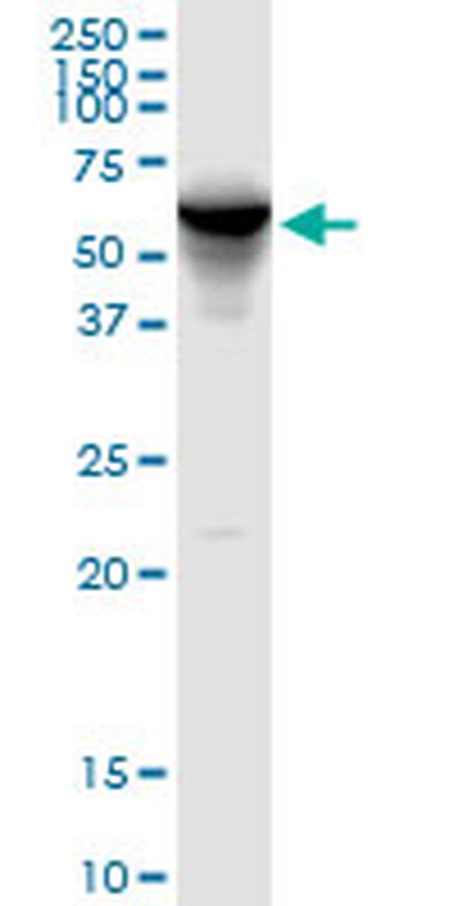 FKBP4 Antibody in Western Blot (WB)