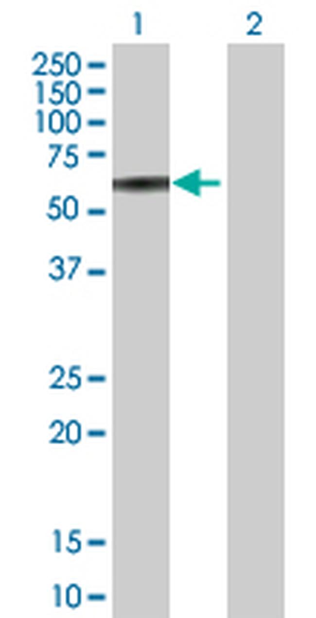 FKBP4 Antibody in Western Blot (WB)