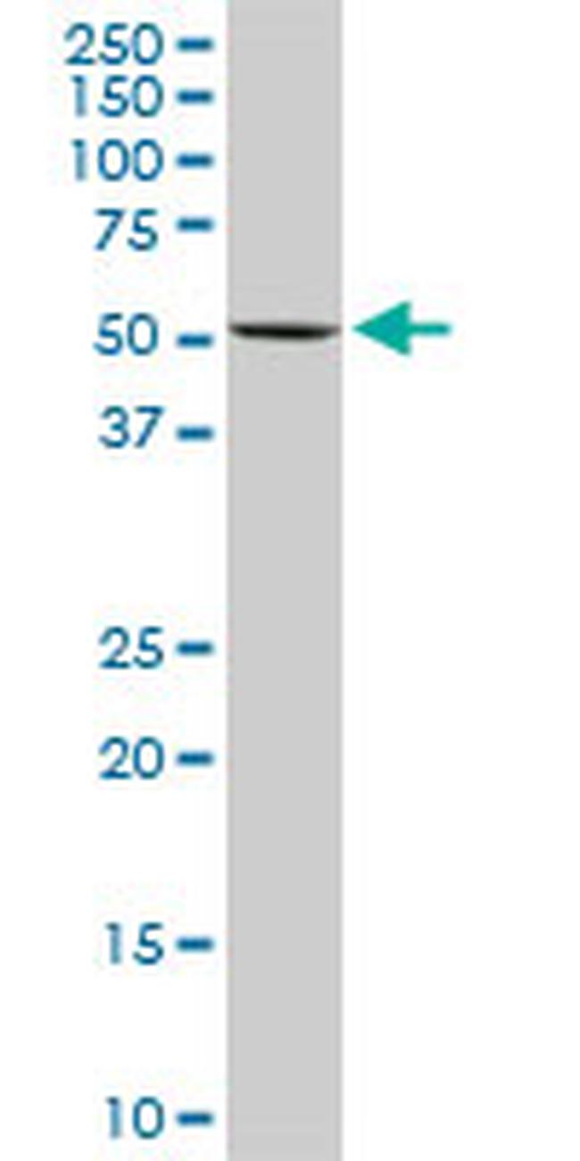 FKBP4 Antibody in Western Blot (WB)