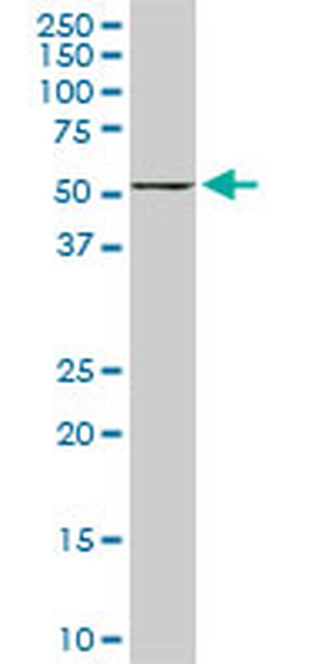 FKBP4 Antibody in Western Blot (WB)