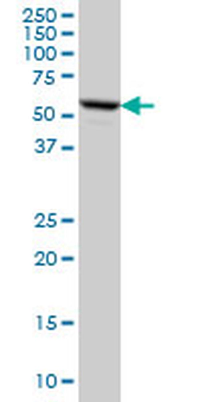 FKBP4 Antibody in Western Blot (WB)