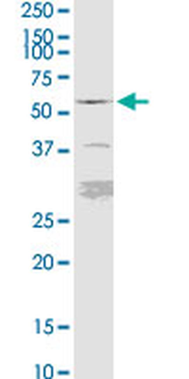 FKBP5 Antibody in Western Blot (WB)