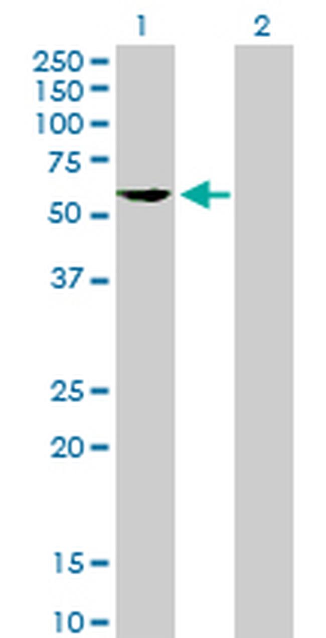 FKBP5 Antibody in Western Blot (WB)