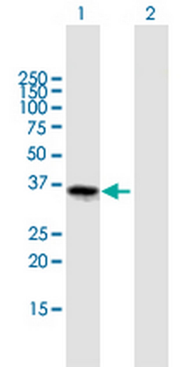 FOXL1 Antibody in Western Blot (WB)