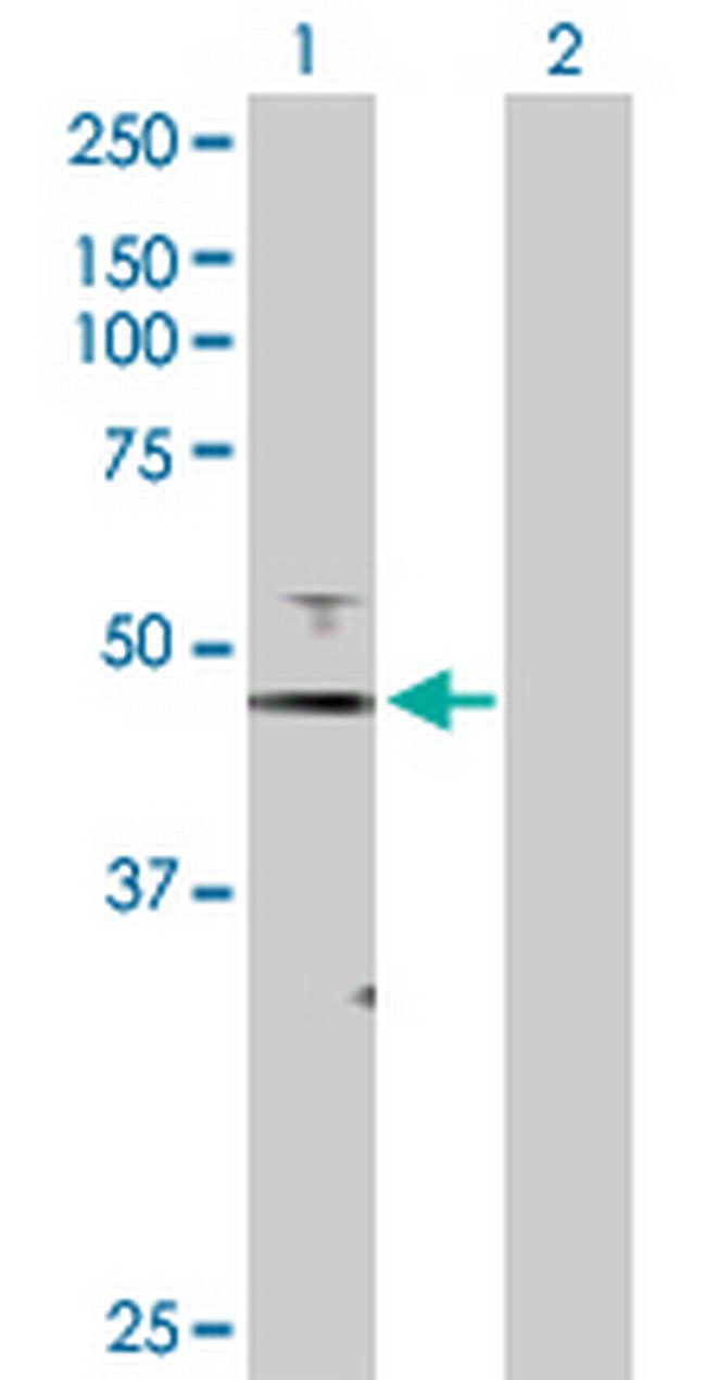 FOXJ1 Antibody in Western Blot (WB)