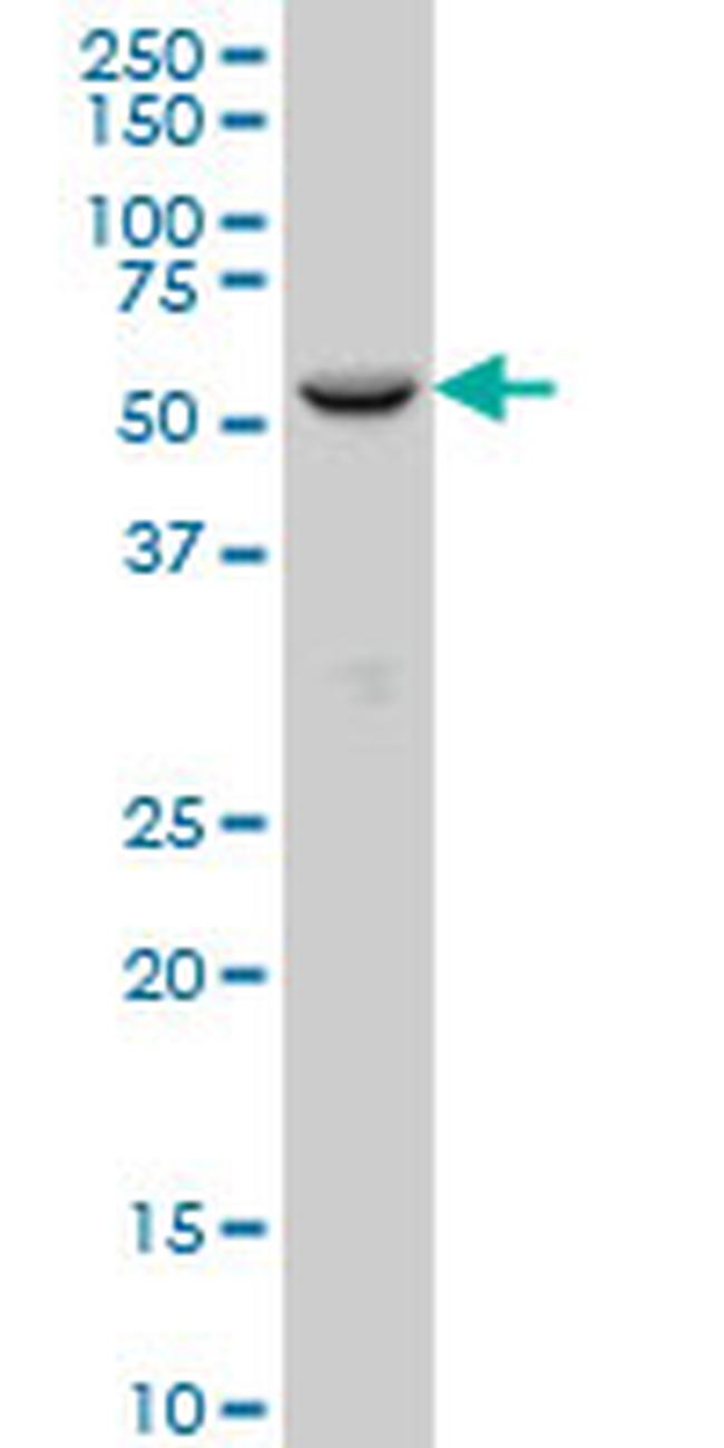 FOXC2 Antibody in Western Blot (WB)