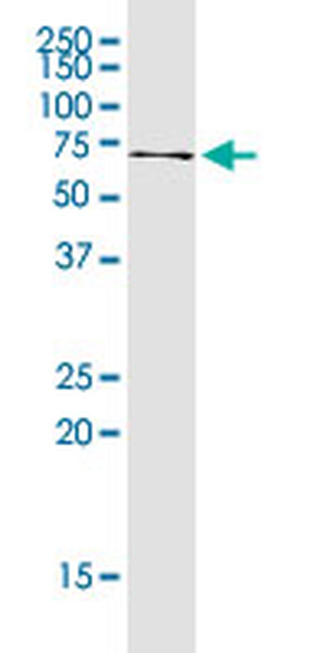 FOXC2 Antibody in Western Blot (WB)