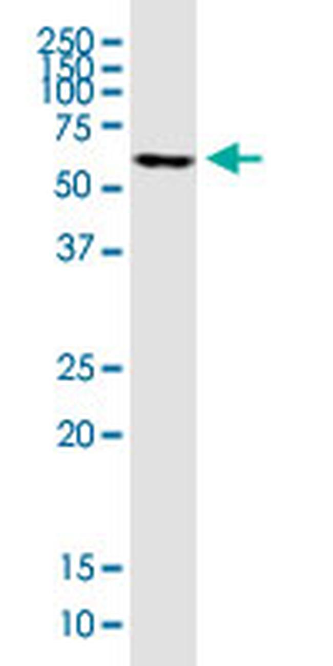 FOXC2 Antibody in Western Blot (WB)