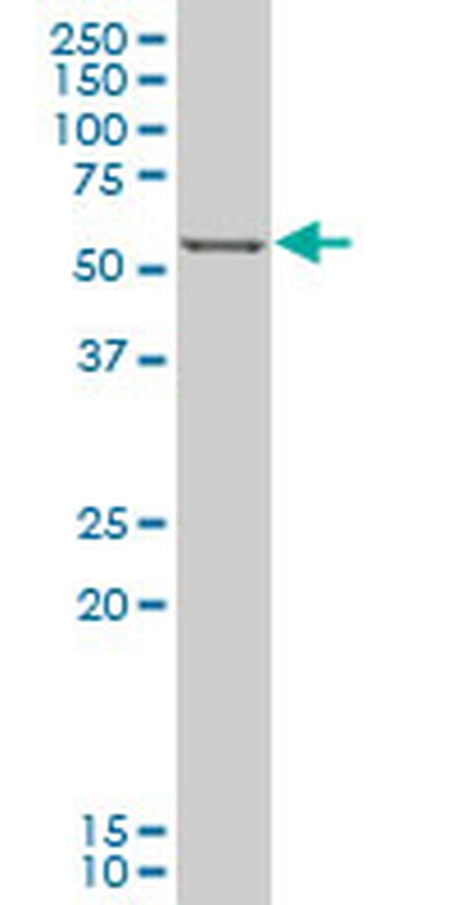 FOXC2 Antibody in Western Blot (WB)