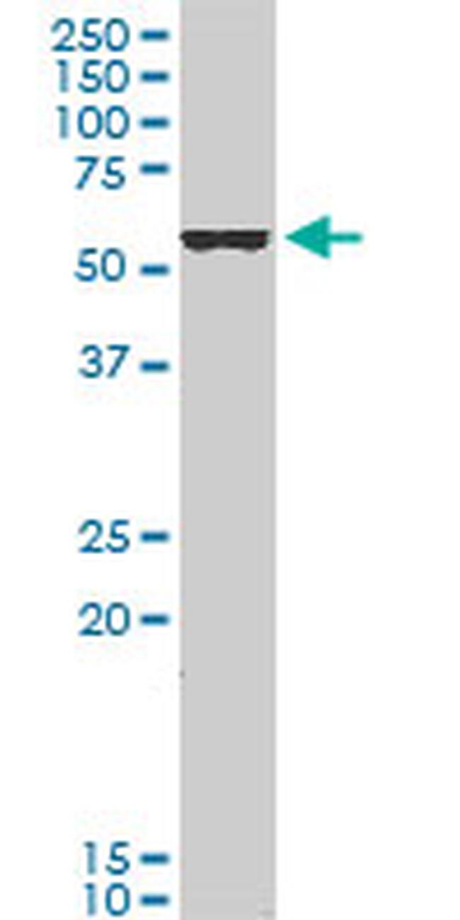 FOXC2 Antibody in Western Blot (WB)