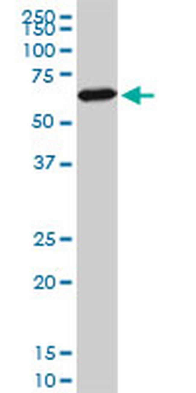 FOXC2 Antibody in Western Blot (WB)