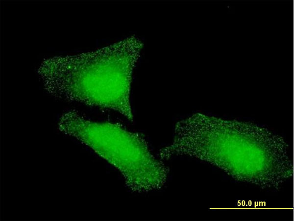 FOXO1A Antibody in Immunocytochemistry (ICC/IF)