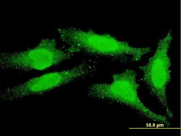 FOXO1A Antibody in Immunocytochemistry (ICC/IF)