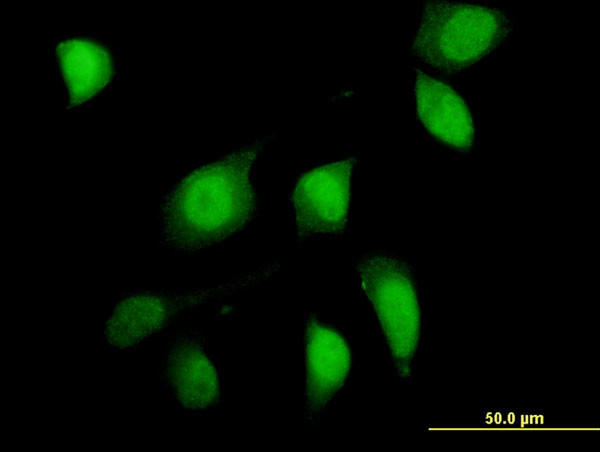 FOXO1A Antibody in Immunocytochemistry (ICC/IF)