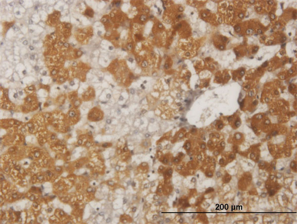 FOXO1A Antibody in Immunohistochemistry (Paraffin) (IHC (P))