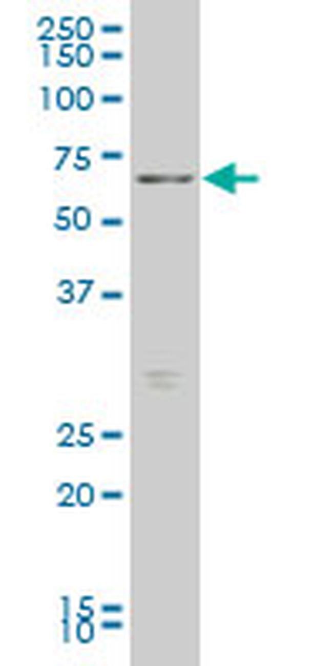 FOXO1A Antibody in Western Blot (WB)