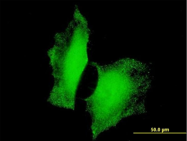 FOXO3A Antibody in Immunocytochemistry (ICC/IF)