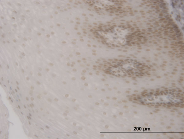 FOXO3A Antibody in Immunohistochemistry (Paraffin) (IHC (P))