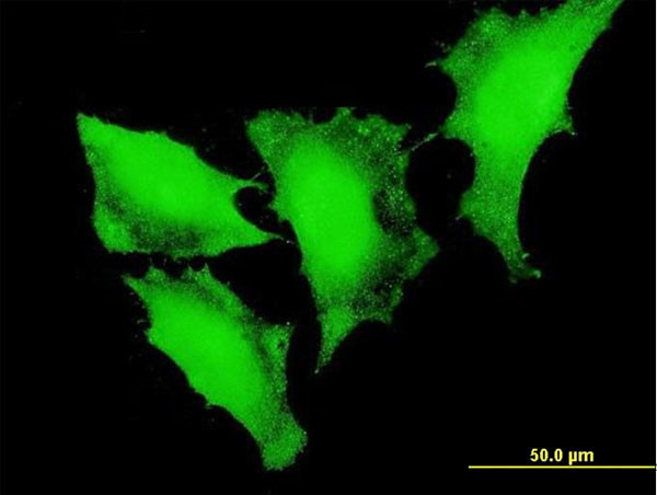 FOXO3A Antibody in Immunocytochemistry (ICC/IF)